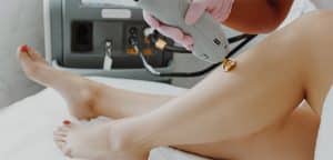 todo lo que debes saber acerca de la depilacion laser diodo img1 - desancho